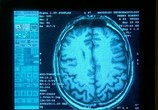 Сцена из фильма BBC: Тайны мозга / Brain Story (2000) 